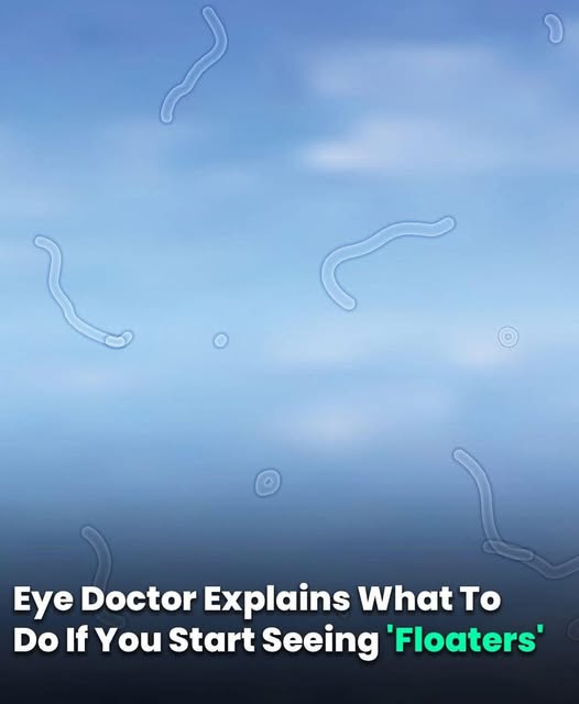 Eye Doctor Explains What To Do If You Start Seeing