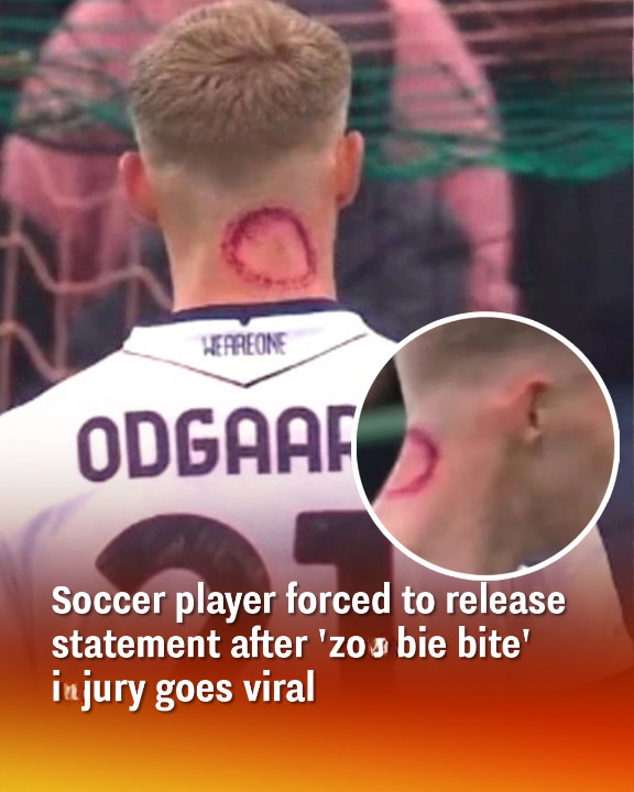 Serie A player forced to