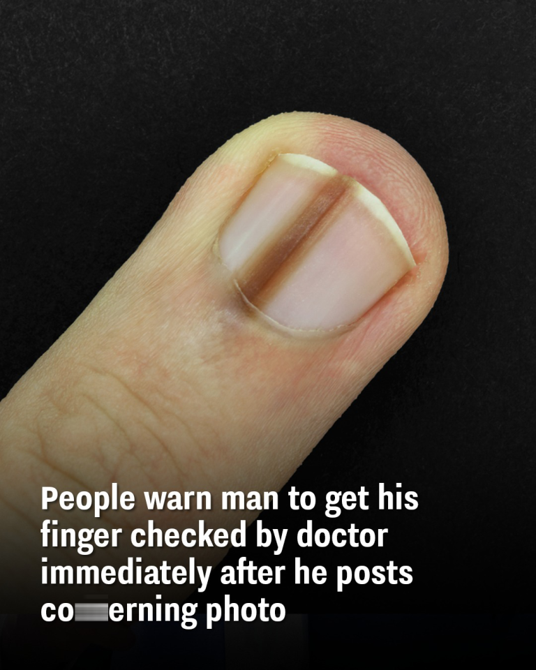 People warn man to get his finger checked