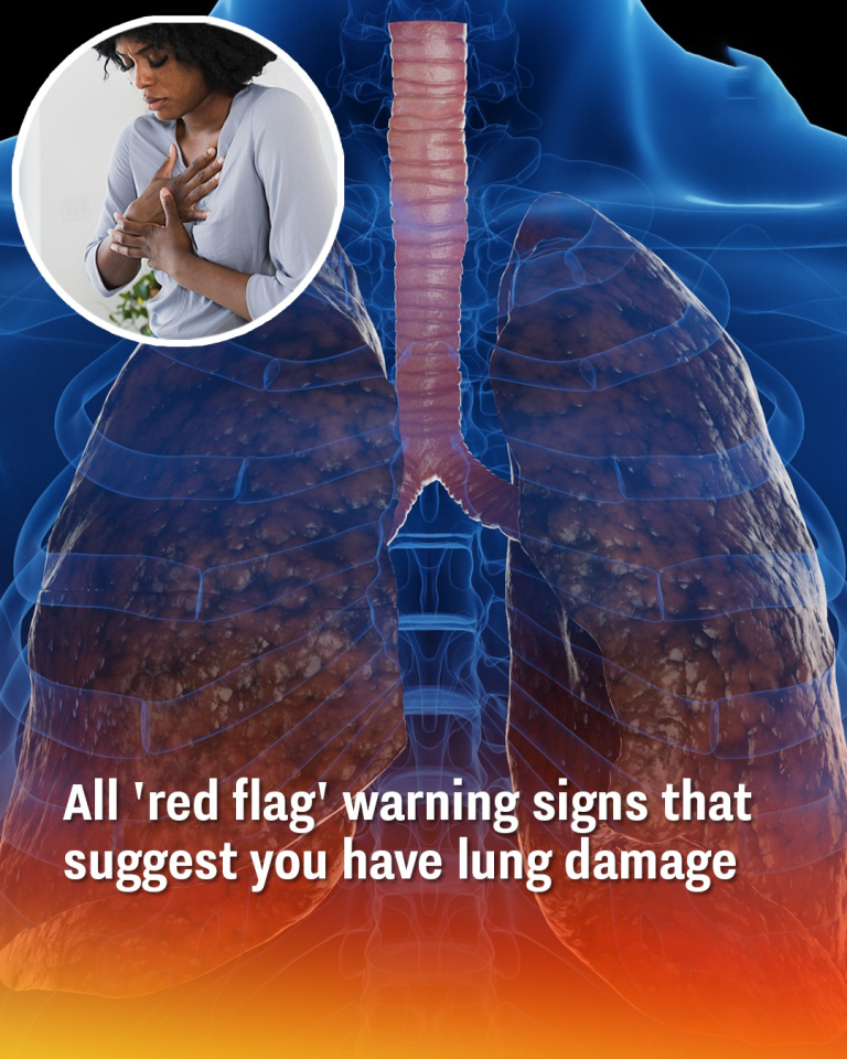 All ‘red flag’ warning signs that suggest you have lung damage