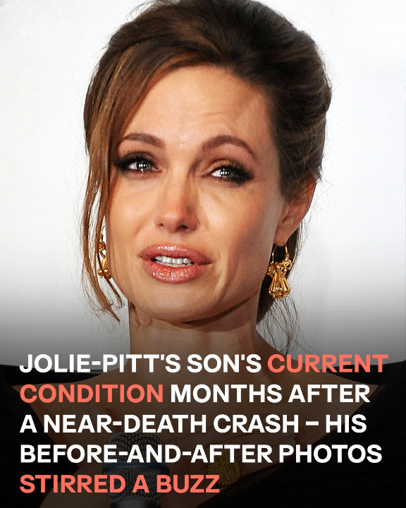 Jolie-Pitt’s Son’s Current Condition Months After a Near-Death Crash – His Before-and-After Photos Stirred a Buzz